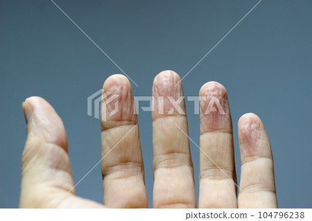Five fingers. Five fingers. 104796238