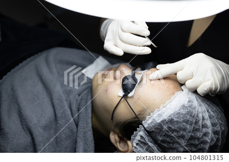 Hands of Dermatologist clearing blackhead,removing acne inflammation,asian teenage woman extracting acne spot on face,lying on bed in beauty clinic,pimple extraction,facial treatment,skin care concept Hands of Dermatologist clearing blackhead,removing acne inflammation,asian teenage woman extracting acne spot on face,lying on bed in beauty clinic,pimple extraction,facial treatment,skin care concept 104801315