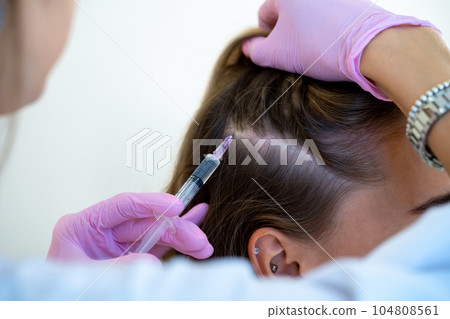 Unrecognizable doctor doing vitamin injections in customers head skin of hair area. 104808561
