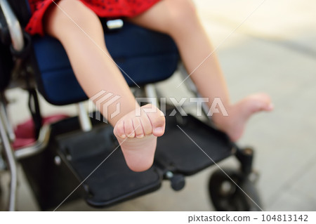 Disabled girl sitting in wheelchair. Close up photo of her legs spasticity muscles . Child cerebral palsy. Disability. Inclusion. 104813142