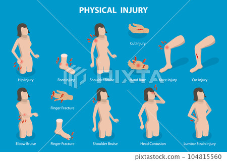 3D Isometric Flat Vector Conceptual Illustration of Physical Injuries 104815560