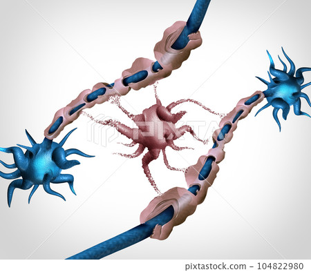 Oligodendrocyte Myelin Damage - Stock Illustration [104822980] - PIXTA