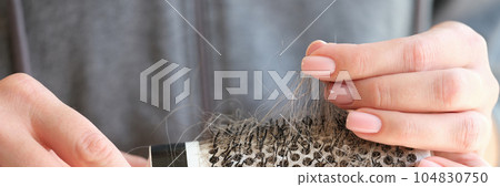 Woman holds a comb with a lot of hair in her hands. Woman holds a comb with a lot of hair in her hands. 104830750