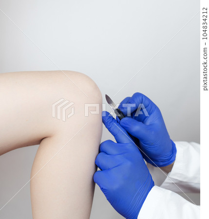 Knee surgery. Orthopedic surgeon shows patient where the incision will be made to repair the tendon, cartilage, and eliminate the effects of arthralgia. Concept of providing qualified care to patients 104834212