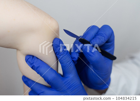 Knee surgery. Orthopedic surgeon shows patient where the incision will be made to repair the tendon, cartilage, and eliminate the effects of arthralgia. Concept of providing qualified care to patients 104834215