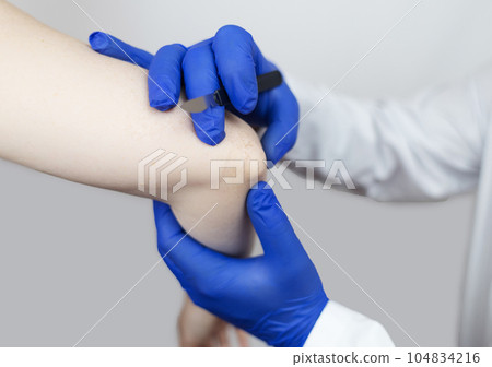 Elbow surgery. Surgeon shows the patient where the incision will be with scalpel for operation due to tendon rupture, cartilage damage, bone prick. Concept of restoring joint mobility and arthroplasty 104834216