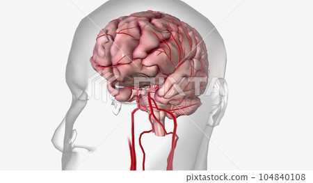 A transient ischemic attack is a mini stroke with similar symptoms to an ischemic stroke but without lasting effects. A transient ischemic attack is a mini stroke with similar symptoms to an ischemic stroke but without lasting effects. 104840108