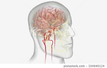 Painful effects of migraine on the brain Painful effects of migraine on the brain 104840124