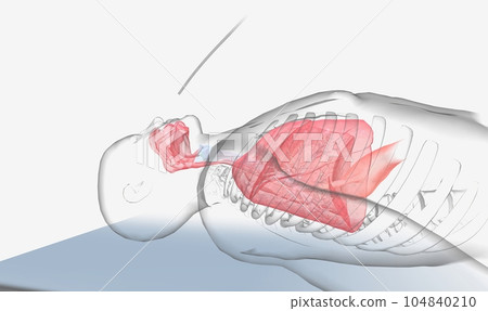 Nasogastric intubation common medical procedure in which a flexible tube is inserted through the nose into the stomach. Nasogastric intubation common medical procedure in which a flexible tube is inserted through the nose into the stomach. 104840210