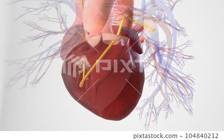 Insertion into the Pulmonary Artery Insertion into the Pulmonary Artery 104840212