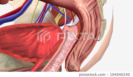Vaginal Vault Prolapse Grade 1 Vaginal Vault Prolapse Grade 1 104840240