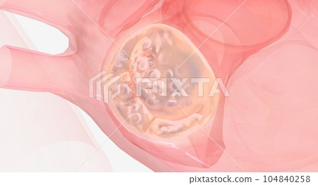 The repaired heart valve is working properly The repaired heart valve is working properly 104840258