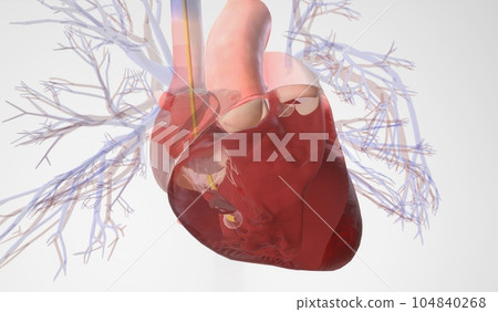 Pulmonary Artery Catheter Insertion into the Right Ventricle Pulmonary Artery Catheter Insertion into the Right Ventricle 104840268