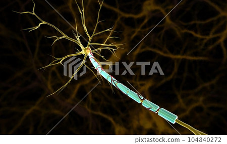 Loss of blood supply to nerve Loss of blood supply to nerve 104840272