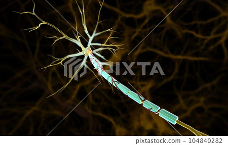 Loss of blood supply to nerve 104840282