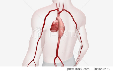 The Thoracic Aortic Aneurysm 3D The Thoracic Aortic Aneurysm 3D 104840389