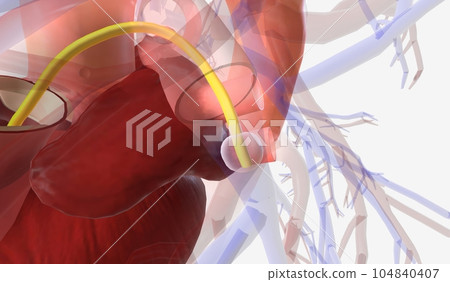 The Pulmonary Artery Catheter (PAC) The Pulmonary Artery Catheter (PAC) 104840407