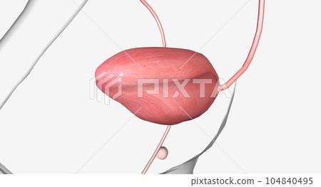 A urethral diverticulum is a rare condition in which a sac or ou A urethral diverticulum is a rare condition in which a sac or ou 104840495