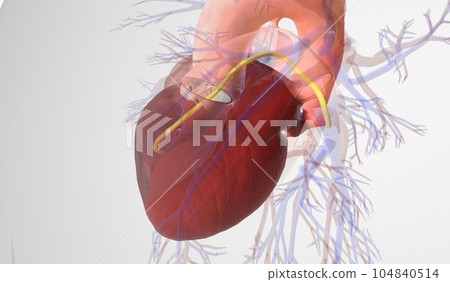 The Pulmonary Artery Catheter (PAC) 104840514