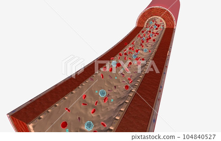 Sickle cell disease is a disease characterized by atherosclerosis and insufficient oxygen to body tissues 104840527