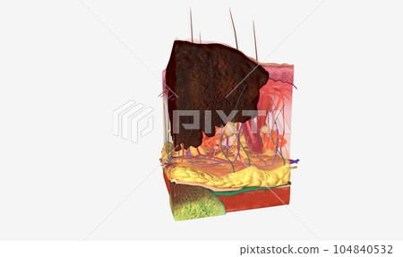 The Stage III melanoma tumors The Stage III melanoma tumors 104840532