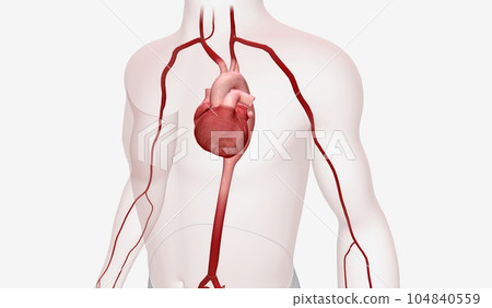 The Thoracic Aortic Aneurysm 3D The Thoracic Aortic Aneurysm 3D 104840559