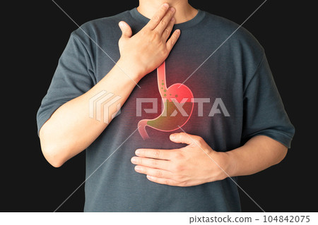 Gastroesophageal reflux disease (GERD) or acid reflux symptoms. Man suffering from heartburn, stomachache, nausea and bloating. Gastrointestinal system disease and digestive problems. 104842075