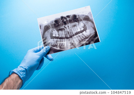 A dentist holding snapshot the patient's tooth and indicates the problem. Panoramic shot of the jaw on a blue isolated background. A dentist holding snapshot the patient's tooth and indicates the problem. Panoramic shot of the jaw on a blue isolated background. 104847519