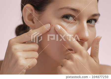 Skin Problem. Depressed Woman Touching Pimple On Her Face Skin Problem. Depressed Woman Touching Pimple On Her Face 104877250