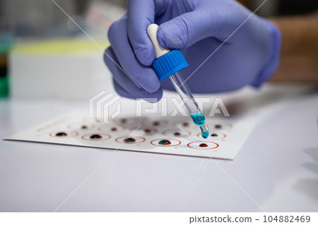 hands wear rubber gloves dripping blue serum using a pipette 104882469