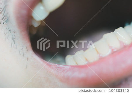 teeth, tooth, mouth 104883540