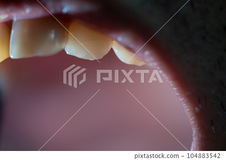 teeth, mouth, oral 104883542