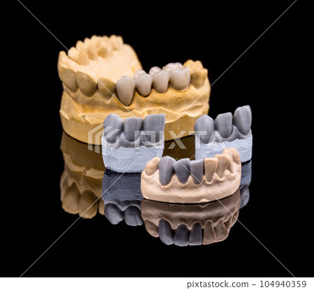 Set of dentures 104940359