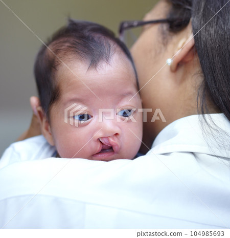 Medical, cleft lip and a pediatrician with a baby in the hospital for insurance, care or treatment. Healthcare, children and a doctor woman holding a newborn with a disability in a health clinic Medical, cleft lip and a pediatrician with a baby in the hospital for insurance, care or treatment. Healthcare, children and a doctor woman holding a newborn with a disability in a health clinic 104985693