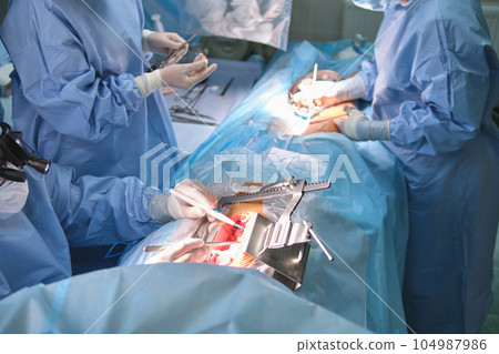 Team of professional doctors operating a patient conducting open heart surgery in surgical room. Healthcare and medical intervention concept Team of professional doctors operating a patient conducting open heart surgery in surgical room. Healthcare and medical intervention concept 104987986