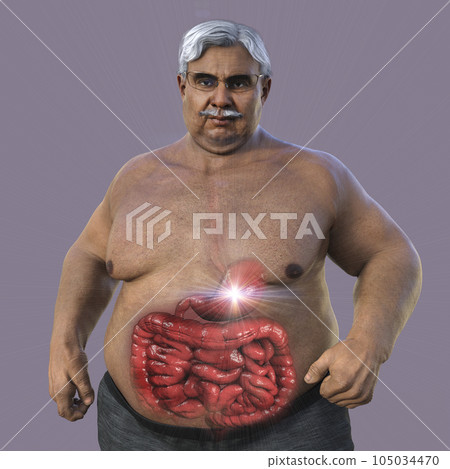 A 3D scientific illustration depicting a senior obese man with transparent skin revealing his intestine A 3D scientific illustration depicting a senior obese man with transparent skin revealing his intestine 105034470