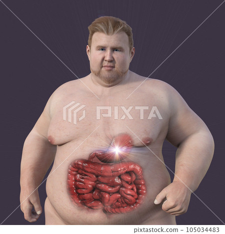 A detailed 3D medical illustration of an overweight man with transparent skin, revealing the digestive system A detailed 3D medical illustration of an overweight man with transparent skin, revealing the digestive system 105034483