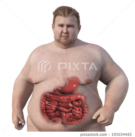 A detailed 3D medical illustration of an overweight man with transparent skin, revealing the digestive system A detailed 3D medical illustration of an overweight man with transparent skin, revealing the digestive system 105034485