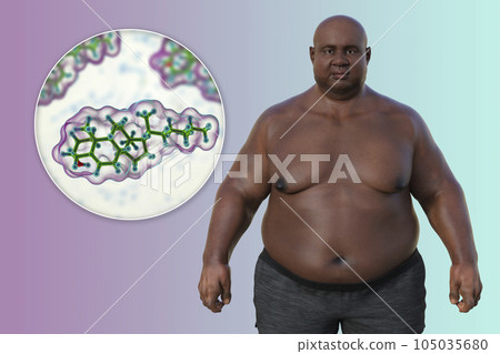 A 3D medical illustration featuring an overweight man with a close-up view of a cholesterol molecule 105035680