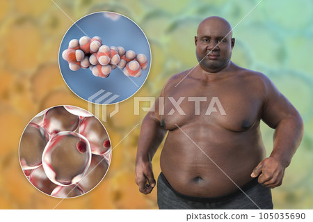 An overweight man with a close-up view of adipocytes and cholesterol molecules, 3D illustration An overweight man with a close-up view of adipocytes and cholesterol molecules, 3D illustration 105035690