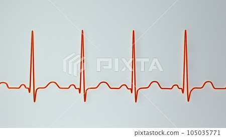 Electrocardiogram ECG displaying sinus tachycardia, 3D illustration Electrocardiogram ECG displaying sinus tachycardia, 3D illustration 105035771
