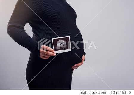 Cropped close up shot of young pregnant female holding sonogram picture of unborn baby inside her pretty belly. 105046300