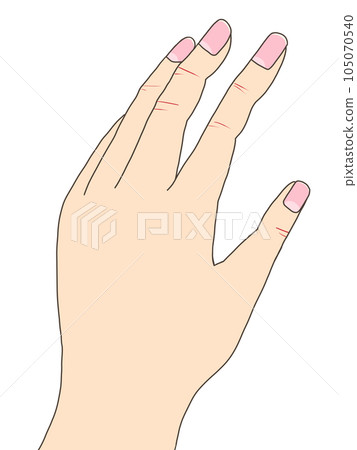 手部問題（乾裂） 105070540