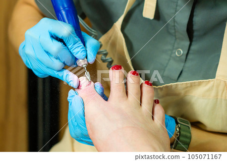 Chiropody. Remove old gel polish Chiropody. Remove old gel polish 105071167
