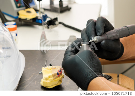 Manufacturing of dentures Manufacturing of dentures 105071718