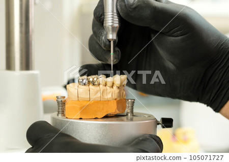 Manufacturing of dental crowns and dentures Manufacturing of dental crowns and dentures 105071727