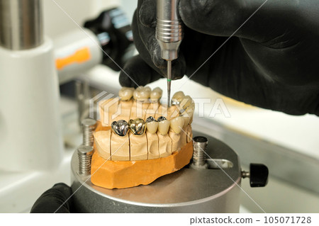 Manufacturing of dental crowns and dentures 105071728