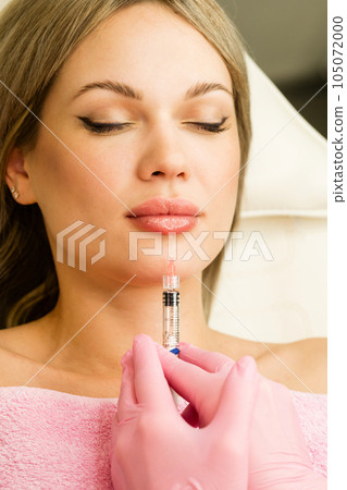 Lip augmentation procedure 105072000