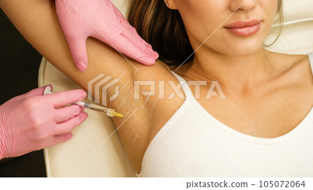 Treatment hyperhidrosis botulinum toxin Treatment hyperhidrosis botulinum toxin 105072064