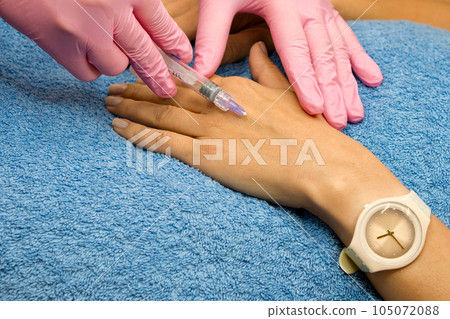 Biorevitalization hand skin rejuvenation for women 105072088